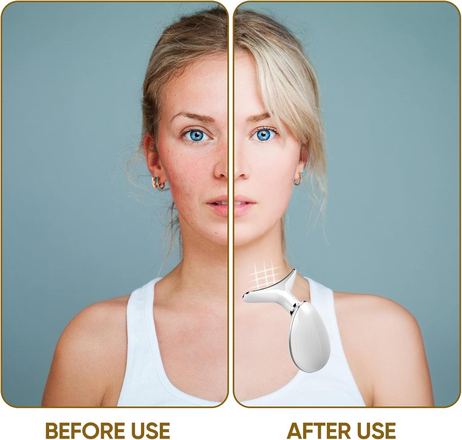 Revitalize Your Skin with the Electric Face Massager - High Frequency Vibration Device for Firming and Wrinkle Removal with 3 Light Modes