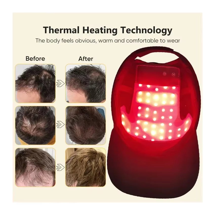Professional Red Light Therapy Cap – Advanced Infrared Hair Growth System