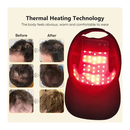 Professional Red Light Therapy Cap – Advanced Infrared Hair Growth System